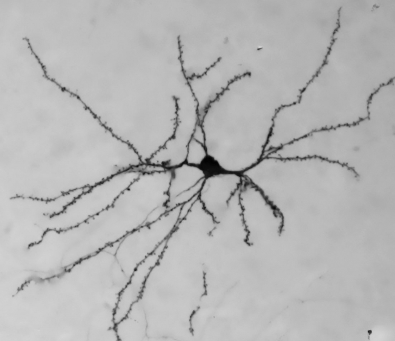 Lonely Neuron