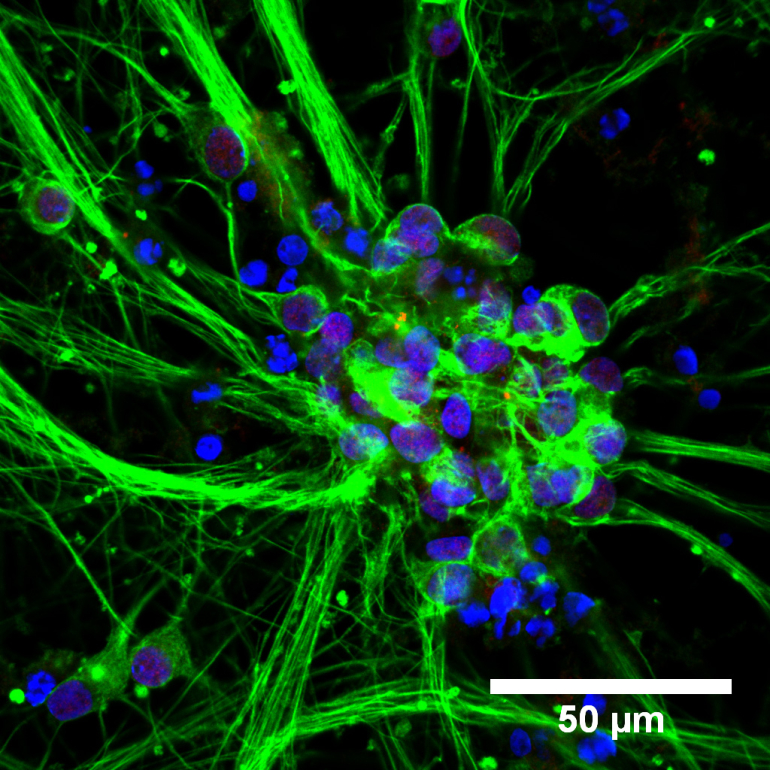 Motor Neurons in vitro