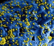 Produced by the National Institute of Allergy and Infectious Diseases (NIAID), this highly magnified, digitally colorized scanning electron microscopic (SEM) image, revealed ultrastructural details at the site of interaction of numerous yellow colored, Middle East respiratory syndrome coronavirus (MERS-CoV) viral particles, located on the surface of a Vero E6 cell, which had been colorized blue